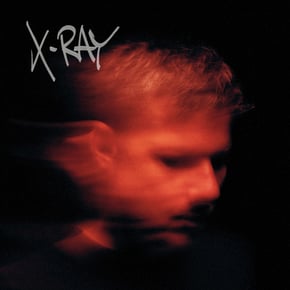 X-Ray by Murdock Cover Art